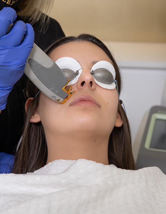 vein removal vein removal